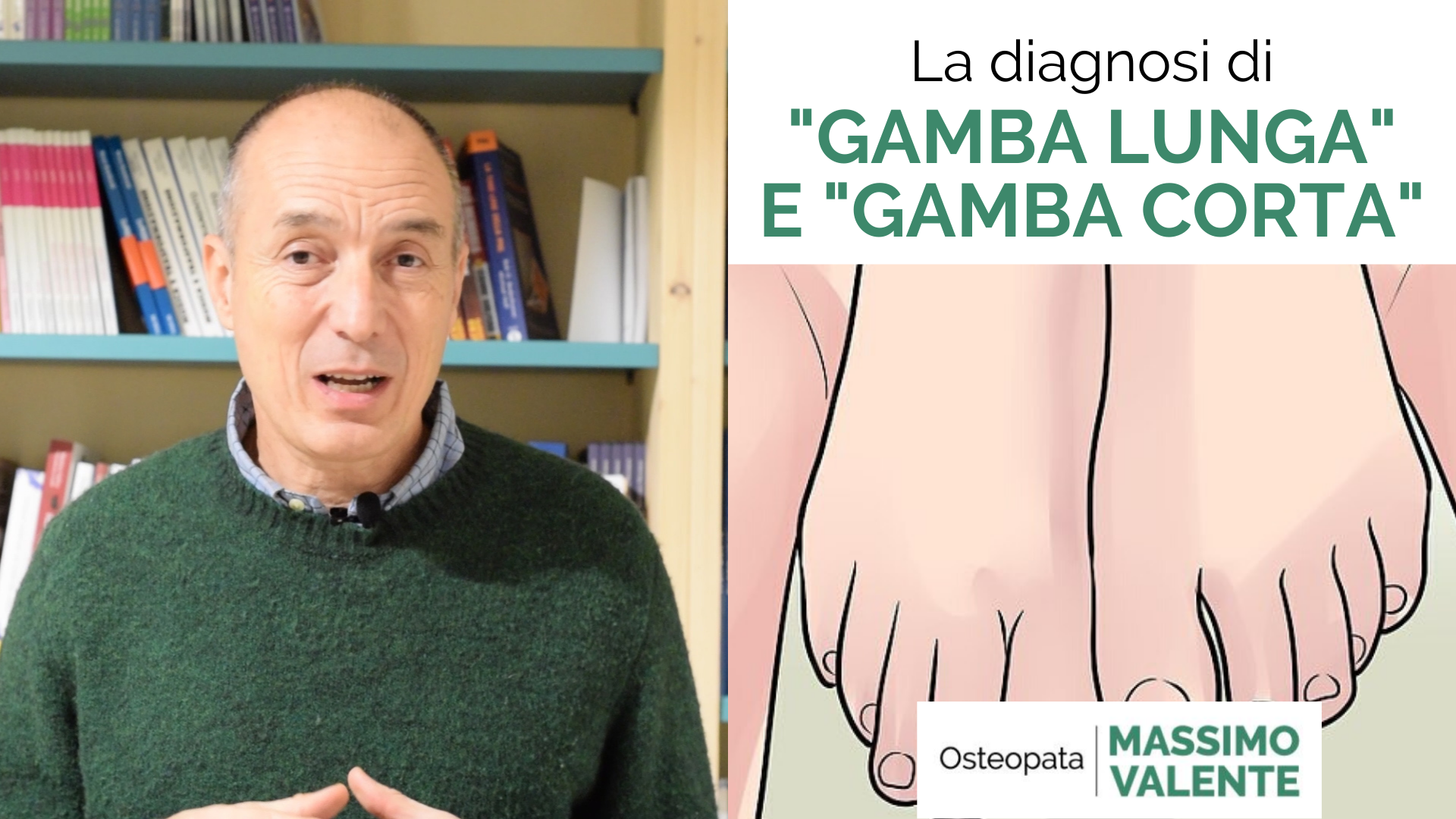 La diagnosi di gamba lunga e gamba corta